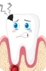 Receding Gums