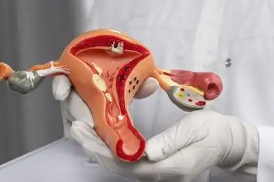 Blocked or Damaged Fallopian Tube Treatment in Lucknow India